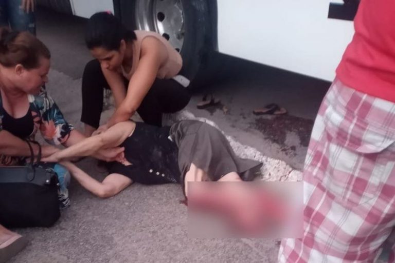 Idosa tem pernas esmagadas ao ser atropelada por ônibus na BR-230