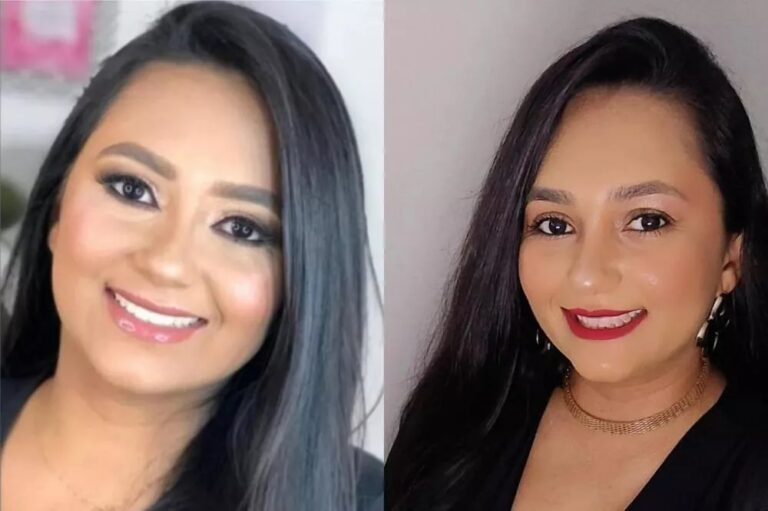 Professora patoense morre em Campina Grande após sofrer AVC hemorrágico