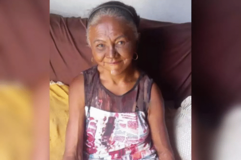 Idosa que sofreu queimaduras em incêndio em Patos tem alta no Trauma de Campina Grande